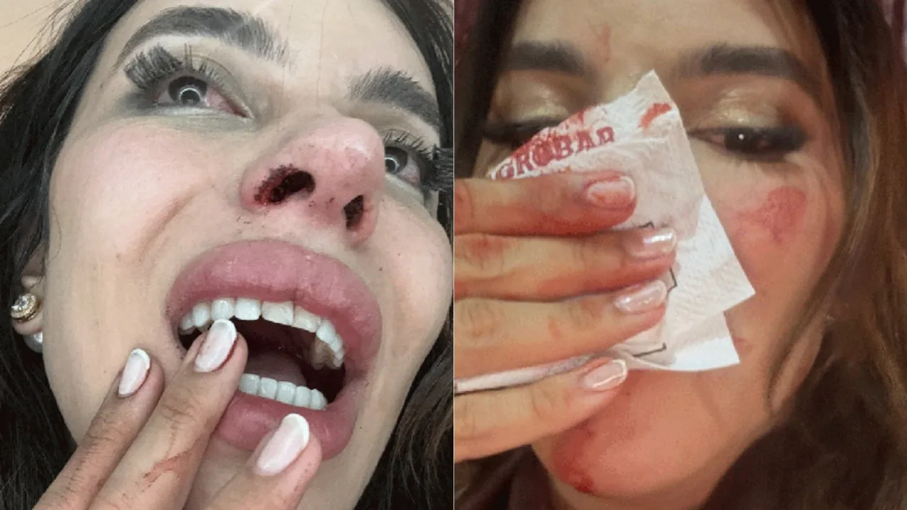 Polícia descarta transfobia em agressão em bar e investiga discursos de ódio contra influenciadora nas redes sociais
