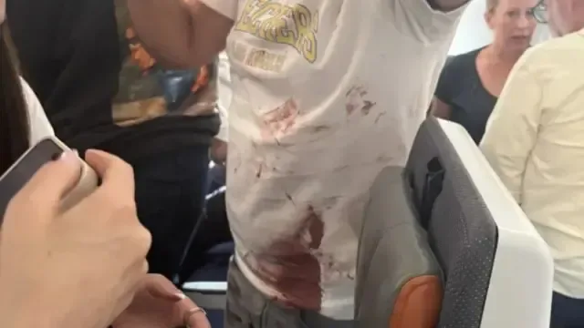 Imagens mostram piloto e passageiro feridos depois de ataque em voo para Israel