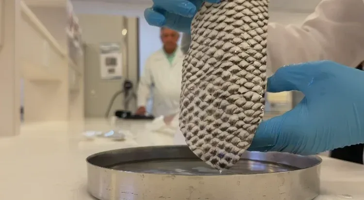Pele de tilápia vira curativo para queimaduras e deve chegar ao SUS