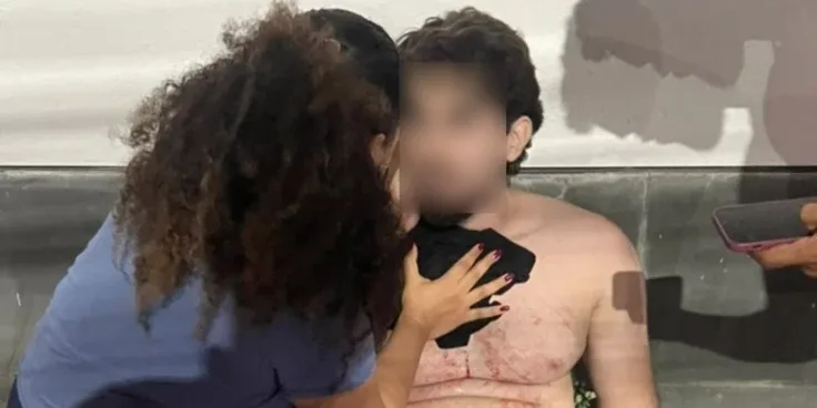 Jovem sofre tentativa de assalto e é baleado na saída de academia, em São Luís