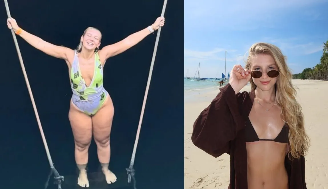 Lauren Pfeiff relata um ano de cirurgia de lipedema: “Impacto positivo”