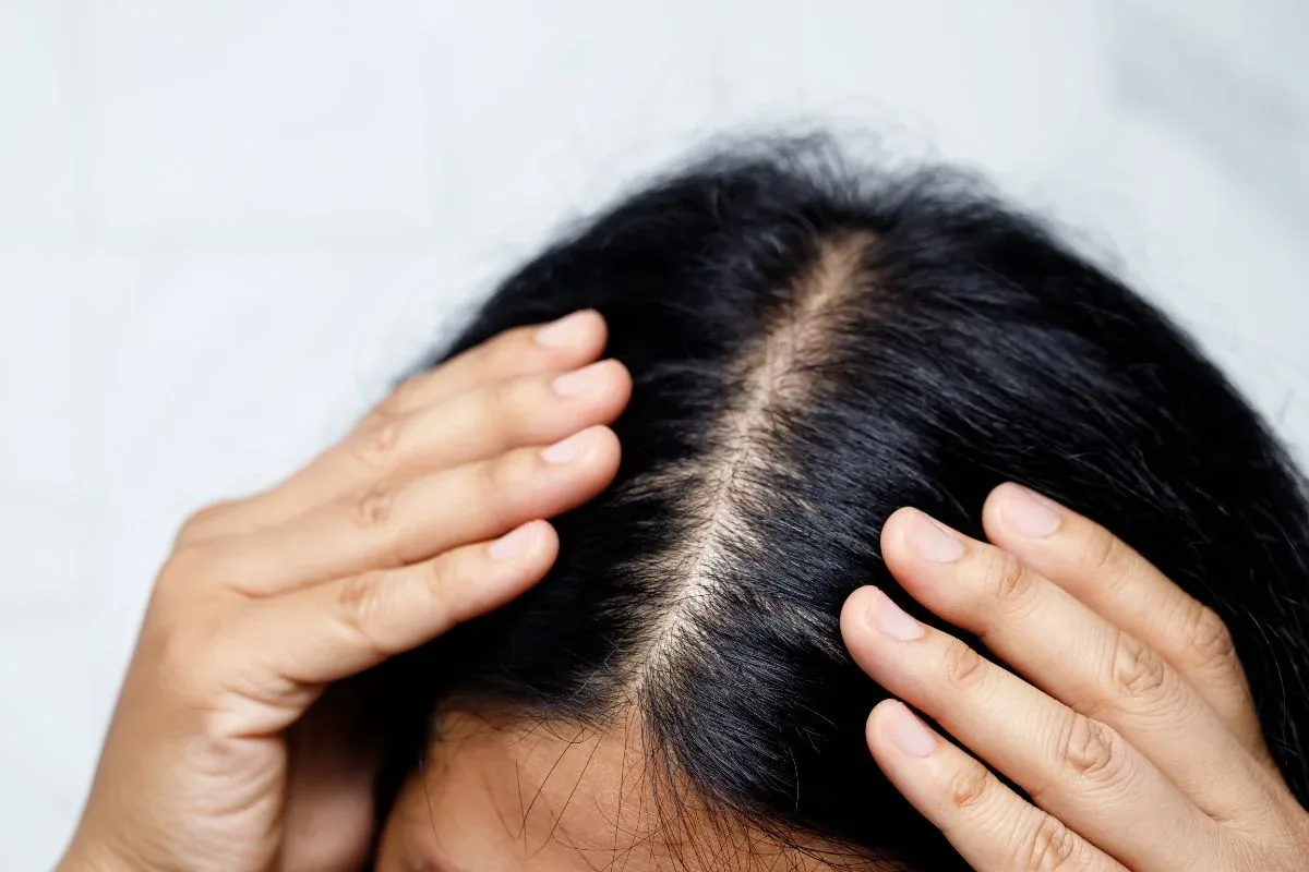 Scab hair: veja cuidados necessários para melhorar a textura capilar