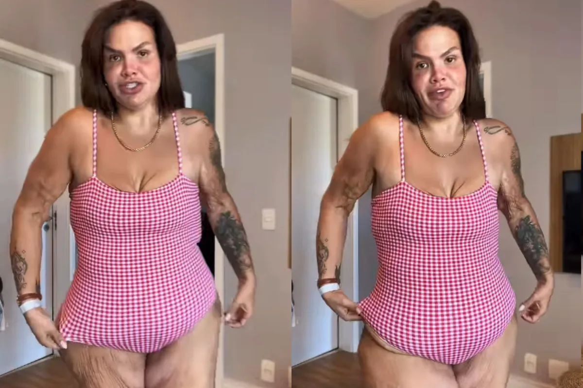 Thais Carla sobre excesso de pele após perder 120 kg: “Não deixo de viver”
