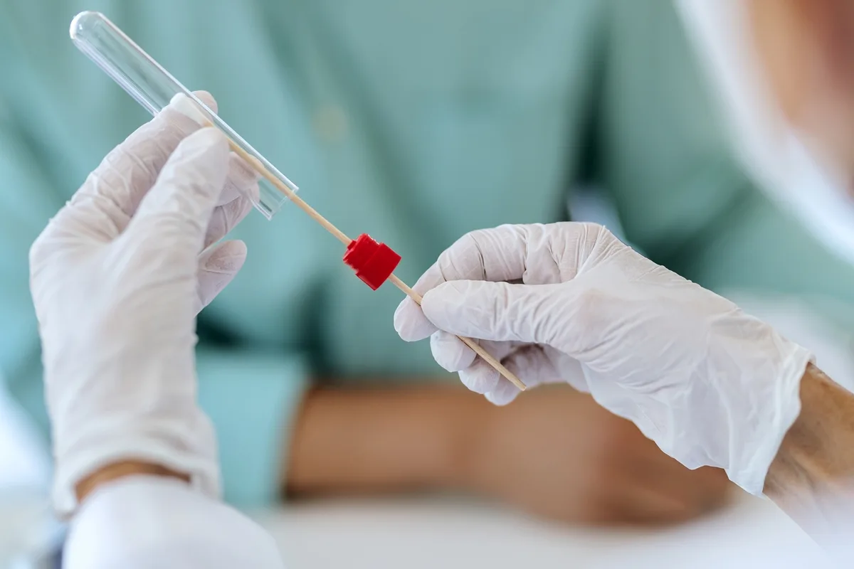Teste com cotonete pode evitar biópsias em casos suspeitos de câncer
