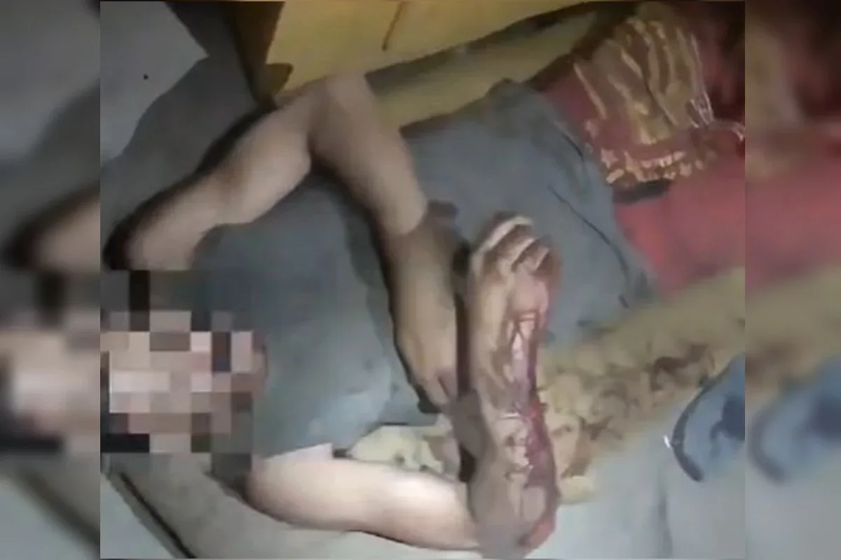 Homem desmaia após ser espancado no Entorno e é socorrido pelos bombeiros