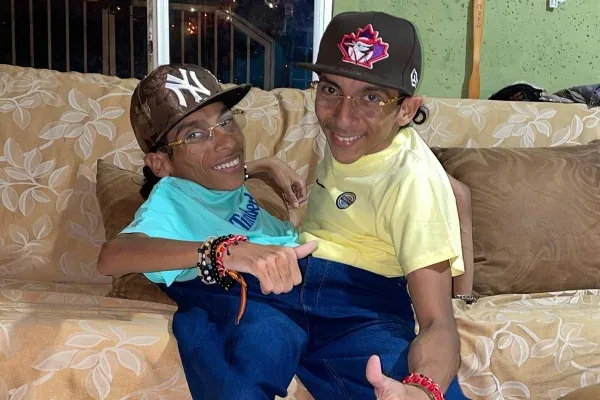 Gêmeos siameses do Equador morrem aos 27 anos na Colômbia