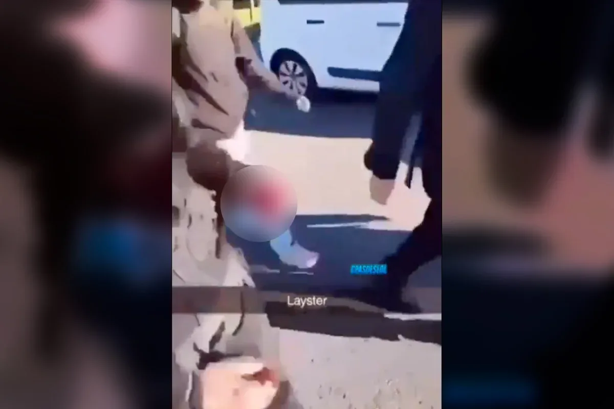 Estudante de 15 anos tem mão arrancada por explosão de granada na França