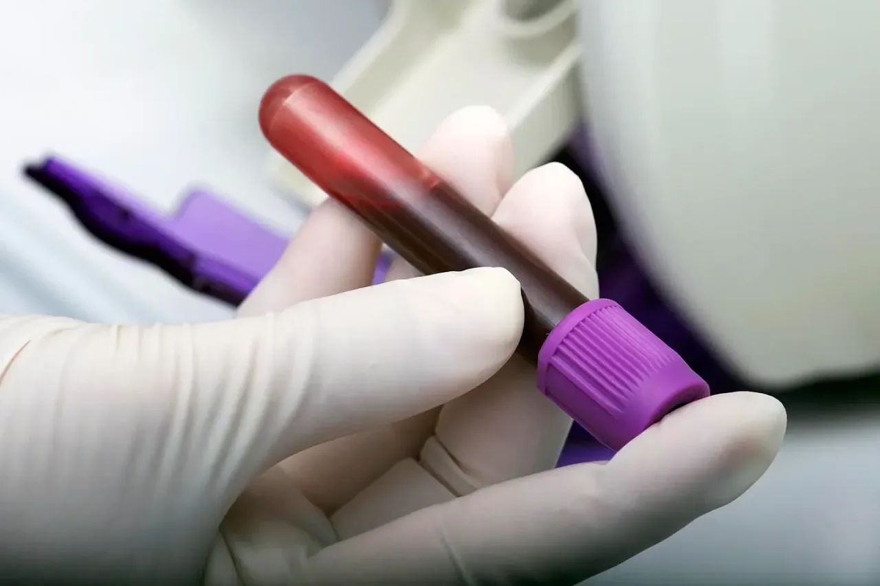 Primeiro exame de sangue para Alzheimer chega ao Brasil; veja preço e quem pode fazer