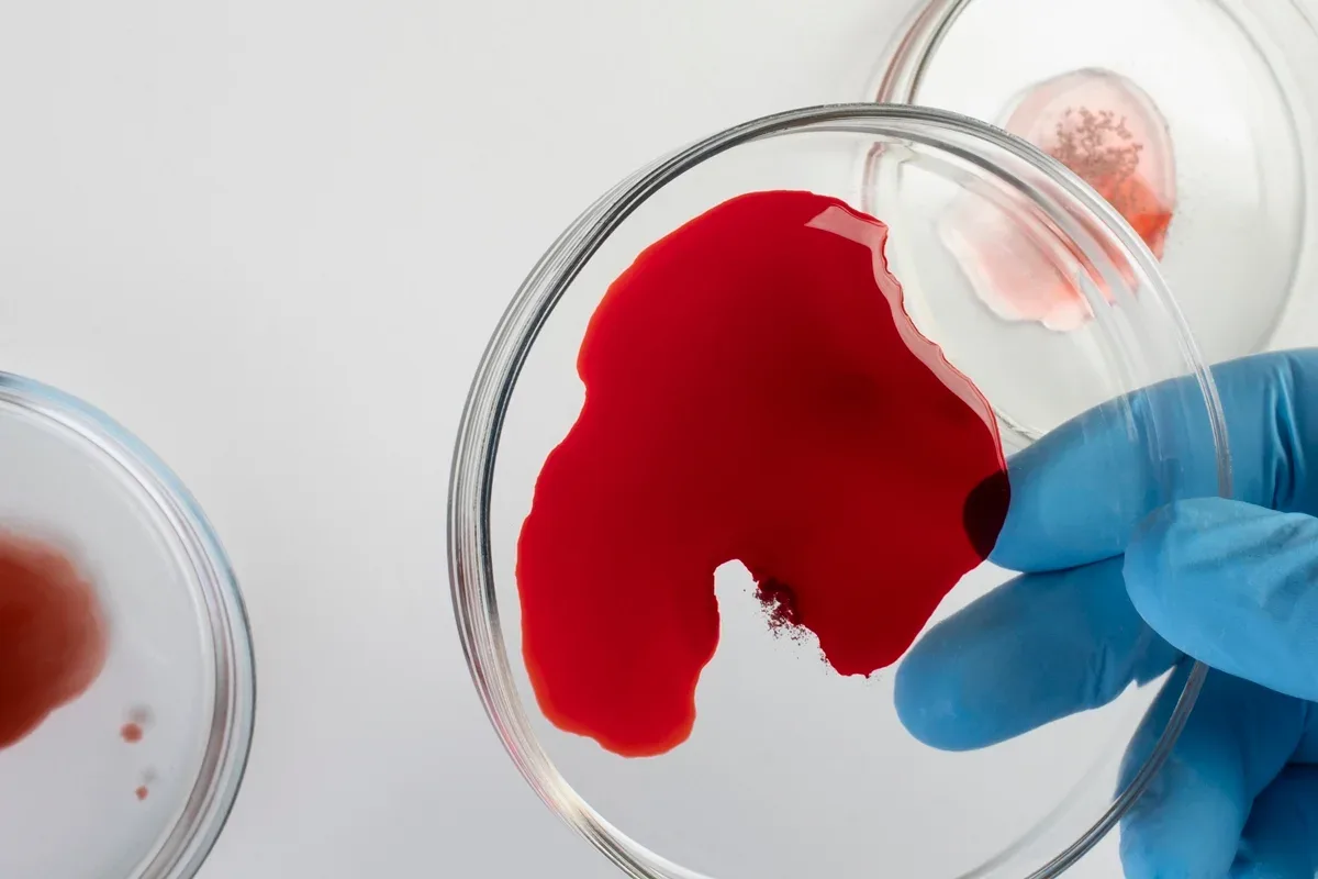 Jejum antes do exame de sangue pode não fazer diferença, sugere estudo